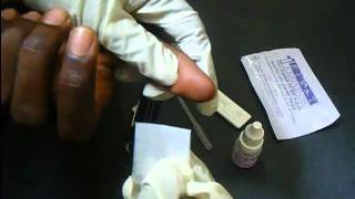 HIV Antibody Test Using a Rapidcard [upl. by Frech483]