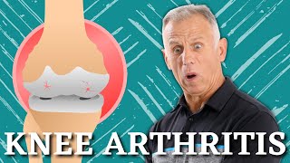 5 Proven Exercises for Knee Osteoarthritis or Knee Pain Do it Yourself [upl. by Ydisahc]