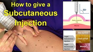 How to Give a Subcutaneous Injection Video [upl. by Sibby]