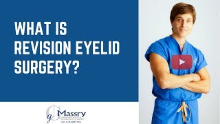 Revision Eyelid Surgery  Fixing Results From Prior Surgeries [upl. by Layor]