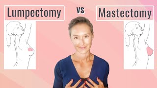 Lumpectomy vs Mastectomy  Benefits and Challenges Explained  My Choice and WHY [upl. by Azilanna]