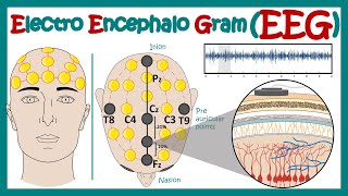 Electroencephalography EEG  How EEG test works  What conditions can an EEG diagnose  Animated [upl. by Popele]