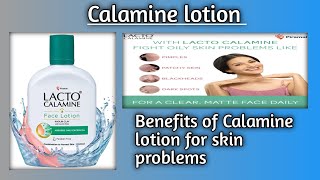 CALAMINE LOTION USES IN HINDI [upl. by Horwitz444]