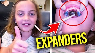 Getting a Palatal ExpanderHow expanders work  McKinney Orthodontist [upl. by Nedmac]