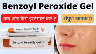 benzoyl peroxide gel 25 how to use hindi  Benzoyl peroxide gel ip benzac ac 25 for acne [upl. by Domeniga]