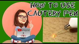 How to use Cautery Pen mole and wart removal pen docmenggay [upl. by Jobe]