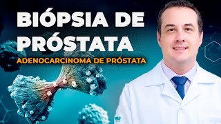 BIÓPSIA da PRÓSTATA RESULTADO ADENOCARCINOMA  Dr André Matos Urologista [upl. by Cortney]