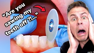 Sawing Through Your Teeth With Braces Orthodontist Reacts [upl. by Rodnas]