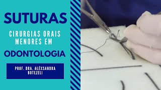 SUTURAS EM CIRURGIAS ORAIS MENORES EM ODONTOLOGIA [upl. by Suolkcin986]