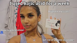 I Used Kojic Acid For A Week amp This Happened  Kojie San Review [upl. by Nylrats860]