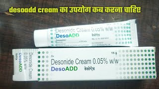 Desoadd Cream Full Review Effects and Side Effects Best for Psoriasis desoadd cream benefits deso [upl. by Mutua688]