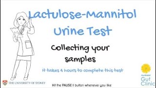 The FIDGIT Study  How to Collect your Urine Samples [upl. by Leanard970]