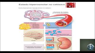 Fisiopatología de la cetoacidosis diabética 👍👍 [upl. by Eiznekam]