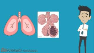 Pulmonary Fibrosis and Systemic Sclerosis [upl. by Sophy232]