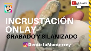 INCRUSTACIÓN DENTAL Porcelana Onlay 👅Grabado y Silanizado [upl. by Avictor103]