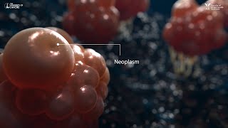 Neoplasm  3D Animation [upl. by Selene]