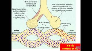 Semiologie de linsuffisance respiratoire Partie 1 [upl. by Ecikram]