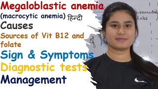 Megaloblastic Anemia  Macrocytic Anemia  Causes  Sign amp Symptoms  Diagnostic Test  Management [upl. by Hillegass253]