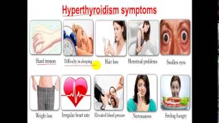 Pathology  dr Nafea  Thyroid Disease  Hyper amp Hypothyroidism  الغدة الدرقية [upl. by Aisyle]