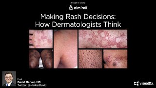 Making Rash Decisions How Dermatologists Think  Dr David Harker [upl. by Hsot]