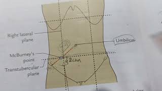 Vermiform Appendix Anatomy [upl. by Shaylah]