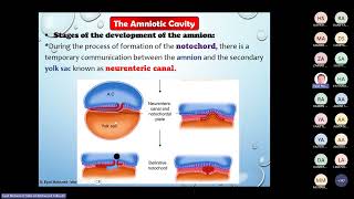 Amnionamp Chorion and Birth Defects Seminar by Dr Eyad [upl. by Lema]