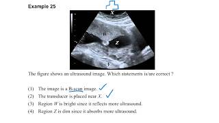 Medical Physics Part 228 Example 25 [upl. by Chavez167]