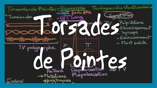 Torsades de pointes ECG symptômes causes et traitement [upl. by Tjaden656]