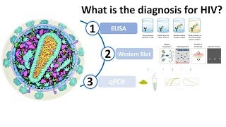 Diagnosis of HIV AIDS [upl. by Weig]