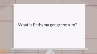 What is Ecthyma gangrenosum [upl. by Enaed]