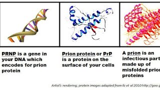 Prions  Prions Disease  Transmissible Spongiform Encephalopathies Diagnosis and treatment [upl. by Cima]