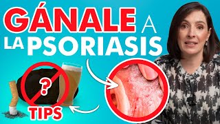 🔴 Si sientes esto tienes PSORIASIS Es CONTAGIOSA drapilarochoa Dermatologa [upl. by Ahsenak494]