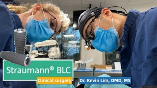 Straumann BLC guided surgery by Dr Kevin Lim DMD MS StraumannGlobal CaryProsthodontics BLC [upl. by Maynord]