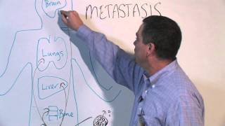 How Cancer Spreads Metastasis  Michael Henry PhD [upl. by Thais752]