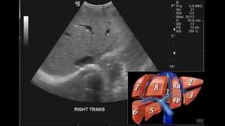 Introduction to the interpretation of Abdominal Ultrasound [upl. by Wenoa]