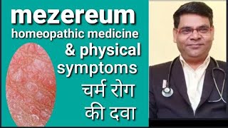 Mezereum 30  Mezereum 200  Mezereum 1m  mezereum homeopathic medicine uses in hindi [upl. by Varuag]