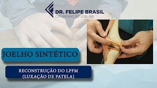 CIRURGIA PARA LUXAÇÃO INSTABILIDADE DA PATELA  WORKSHOP [upl. by Nylsoj]