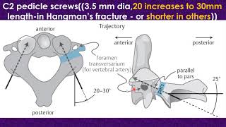 Atlantoaxial subluxation and dislocation [upl. by Yoreel248]