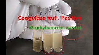 Coagulase test tube method observation [upl. by Goldy913]