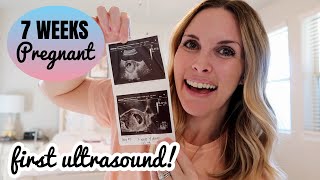 7 WEEK PREGNANCY UPDATE  First ultrasound amp bump shot  Baby 2 [upl. by Stirling269]