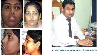 ARPITA SHEULI DASDR ANIRVAN SENGUPTAS PATIENTs INTERVIEW AFTER TREATMENT [upl. by Annavaig611]