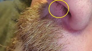 how to remove nose hair without wax [upl. by Ruhtracam]