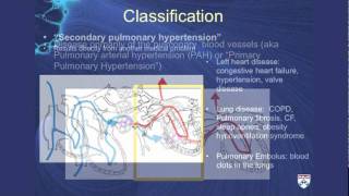 Pulmonary Hypertension A challenging cause of shortness of breath [upl. by Haidabo]