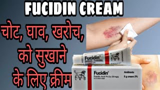 Fucidin cream review in Hindi  चोट घाव खरोच को सुखाने के लिए क्रीम [upl. by Coney]