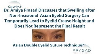 Why Eyelid Surgery Just Like Eye Rubbing can Cause Temporary Swelling in Eyelid Skin [upl. by Analart810]