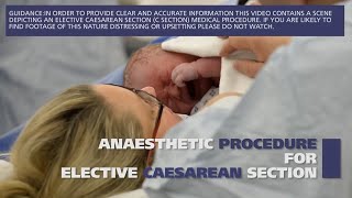 Anaesthetic procedure for elective caesarean section C section [upl. by Ayardna]