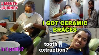 BRACES at THE AGE OF twenties😱 MY 1 MONTH BRACES JOURNEY  METAL OR CERAMIC which is best [upl. by Marrissa580]