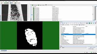 Automated segmentation of trabecular and cortical bone  CTAn  MicroCT [upl. by Annaiel]