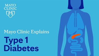 Mayo Clinic Explains Diabetes [upl. by Lourie121]