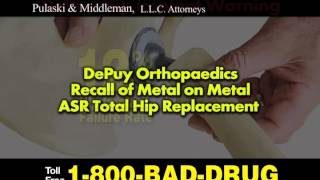 Depuy Hip Implant Recall [upl. by Rramahs]